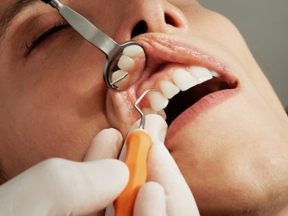 מחלת חניכיים: סימנים, גורמים והחשיבות של אבחון מוקדם